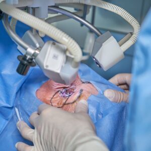 eye laser surgery, eye operation, doctor